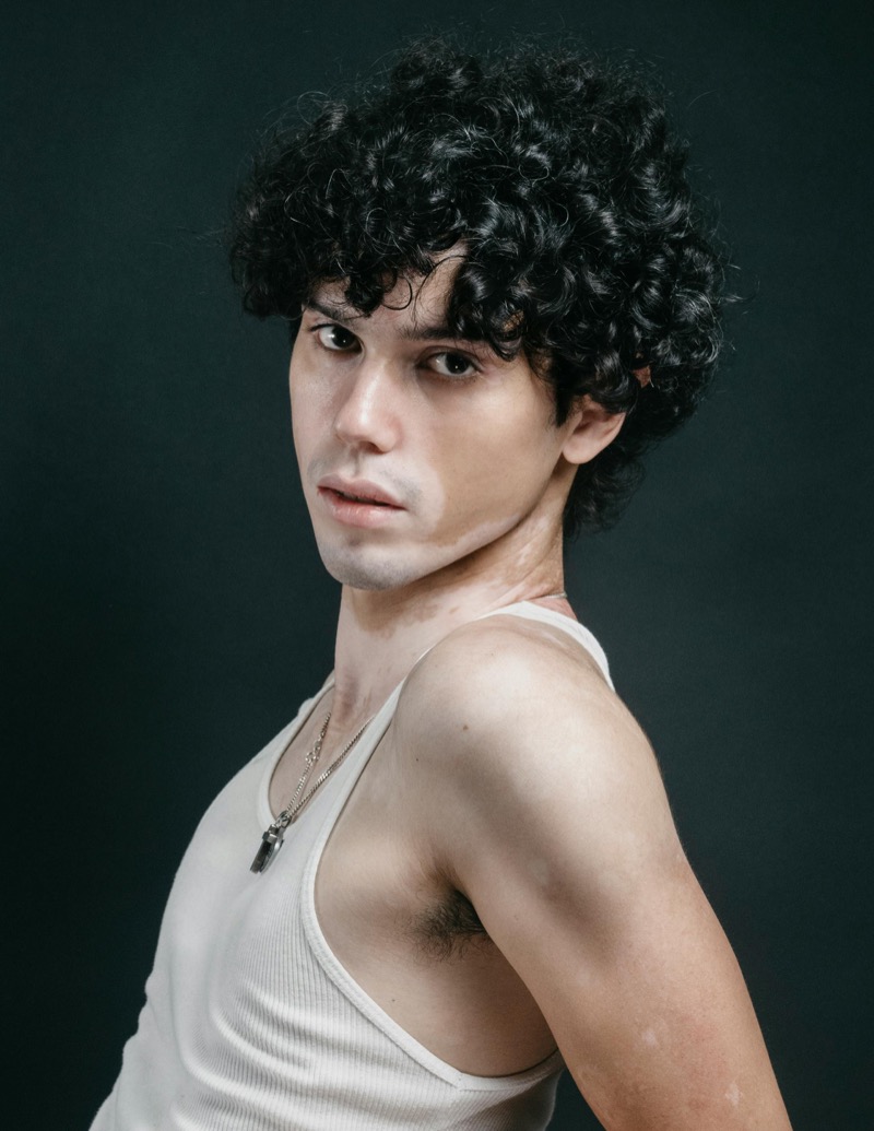 vitiligo male model headshot