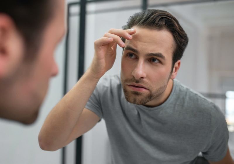 Male Receding Hairline