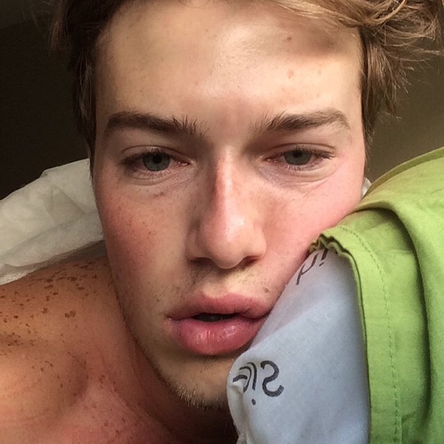 Jake Cassar shares a groggy morning.