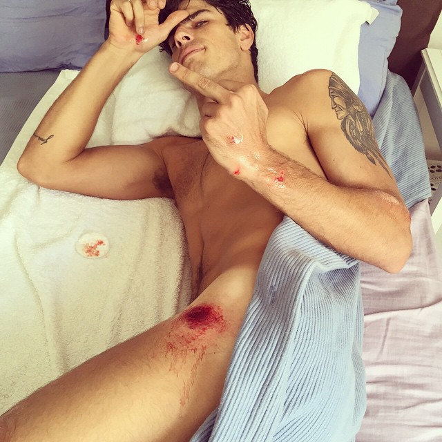 Evandro Soldati shares an unfortunate injury