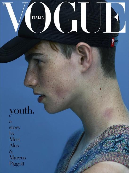 Vogue Italia October 2015 Cover: Aidan Walsh by Mert & Marcus