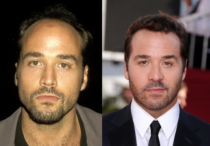 Jeremy-Piven-Before-After-Hair-Transplant.jpg