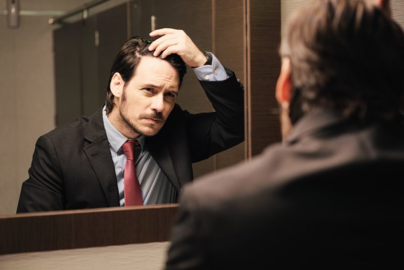 Businessman Hairloss Businessman Hairloss