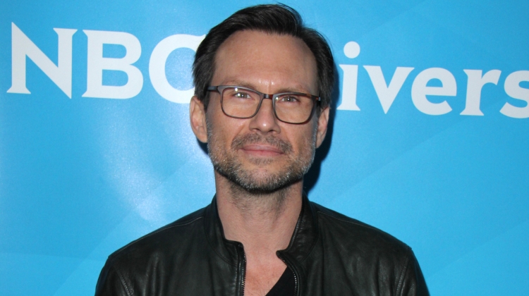 7 Celebrities Who Have Had Hair Transplants