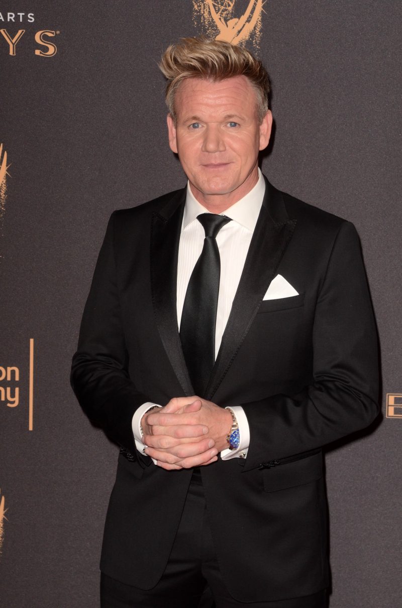 Gordon Ramsay » 7 Celebrities Who Have Had Hair Transplants Gordon Ramsay