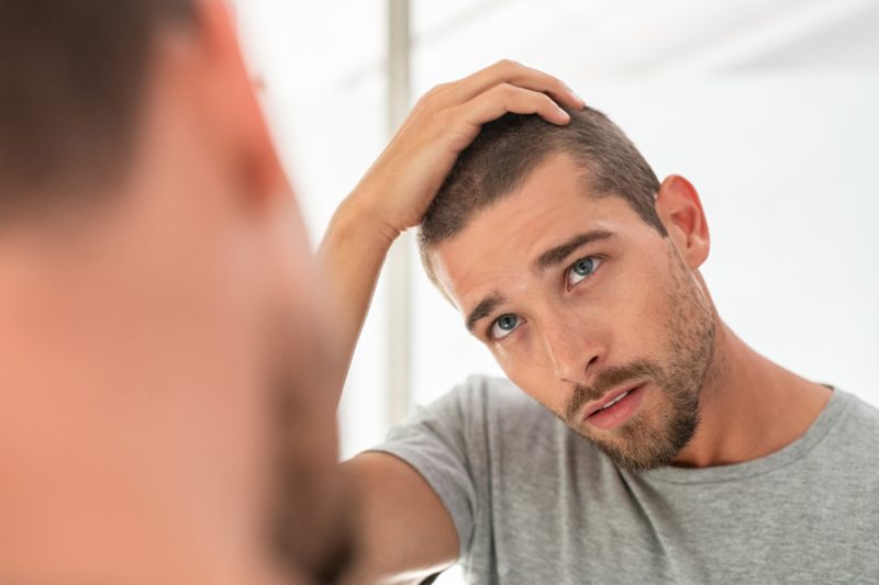 Man Checking for Thinning Hair in Mirror Man Checking for Thinning Hair in Mirror