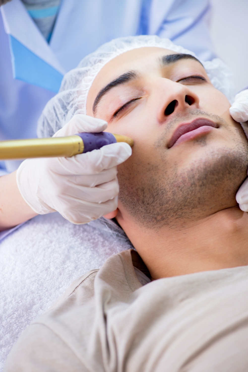 Radiofrequency Energy Treatment Man Face