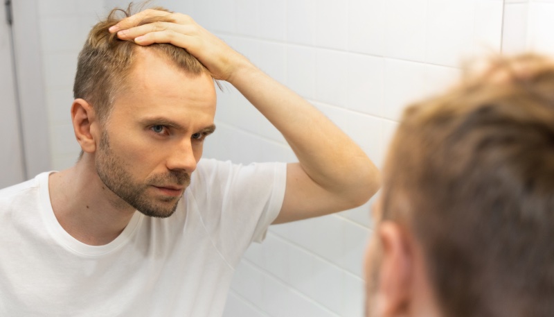 Man Hair Loss Mirror Man Hair Loss Mirror