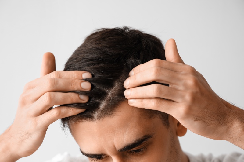 Man Worried Hair Loss Man Worried Hair Loss