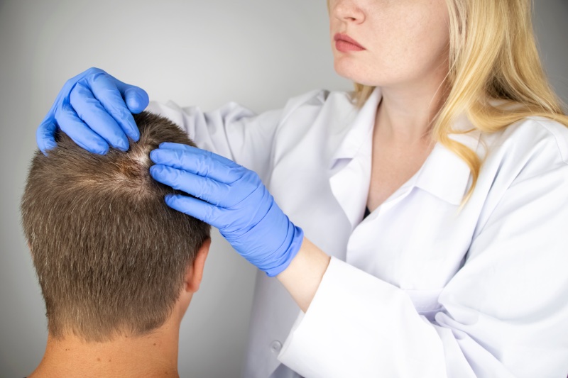 Man Hair Loss Treatment Man Hair Loss Treatment