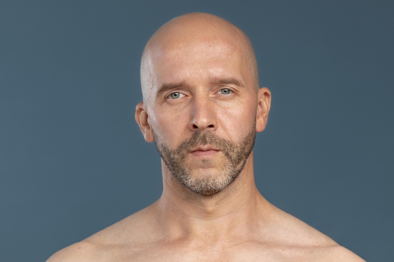 Hair Loss Bald Mature » Male Hair Loss: On the Path to Becoming History Hair Loss Bald Mature