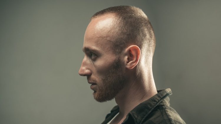 Male Hair Loss: On the Path to Becoming History