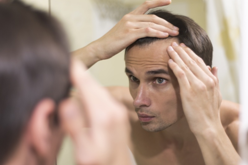 Man Hair Loss Mirror