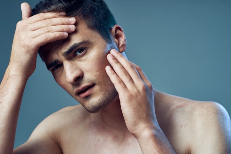 Man pushing his hair back with one hand while examining his cheek with the other
