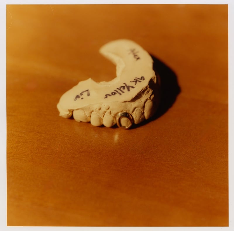 A dental model rests on a warm-toned surface.
